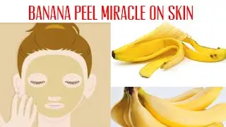BANANA PEEL MIRACLE | CLEAR YOUR SKIN, NO MORE EYE BAGS | AT HOME NATURAL REMEDY (WORKS 100%)