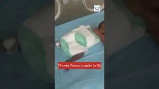 Intensive Care: Twenty Eight Weeks premature Baby born