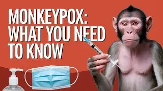 Monkeypox I #monkeypoxtreatment #outbreak