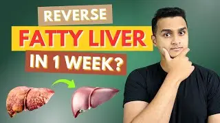 Reverse Fatty Liver in 1 Week? Natural Medicine Doctor Explains | Dr Tomson Jose