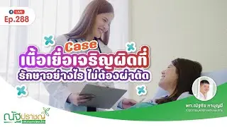 Ep288: Case เนื้อเยื่อโพรงมดลูกเจริญผิดที่ รักษาอย่างไรให้หายไวๆ