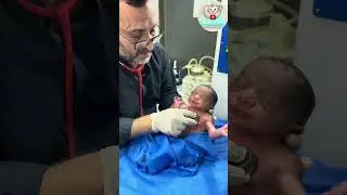 Newborn Examination & Strong Moro Reflex | Baby care with Dr. Shahzad