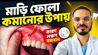 মাড়ি ফুলে গেলে করণীয় | Gum Swelling Treatment in Bangla | Dental Care Tips
