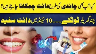 Fastest Way To Whiten Teeth At Home | Best Natural Way to REMOVE TARTAR |Dr Ahmed Hassan