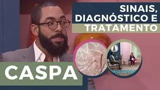 COMO EVITAR E ACABAR COM A CASPA | Dr. João Gabriel Fernandes