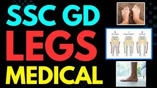 SSC GD Legs Medical #sscgd #medical #sscgdmedical #knockknees #flatfoot 