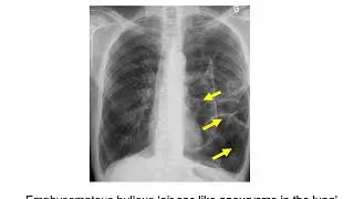 Dr. Manny Learn shop: Chest x-ray interpretation 
