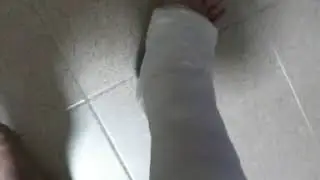 11-Jan , first plaster cast with walking heel