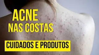 ESPINHAS NAS COSTAS - ACABE, entenda e conhe&ccedil;a os produtos para tratar
