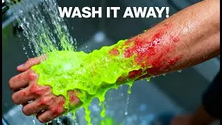 🎵 &ldquo;Wash It Away&rdquo; &ndash; Acid & Chemical Burns Song 🎵