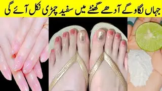 Hands Feet Whitening DIY | Instant Hands Feet Whitening Home Remedies | Hands Whitening Formula