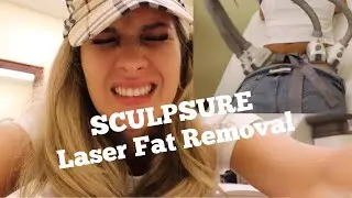 TRYING A LASER FAT REMOVAL!!