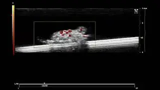 Cardiac Blood Flow in a Fruit Fly