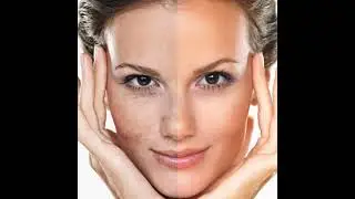 How to get soft and supple skin naturally
