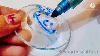 Lenticular lens|Optometry|Eye