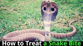 ✅How to Treat a Snake Bite