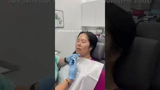 Juvederm Volux for Chin Enhancement
