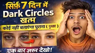 Dark Circles क्यों होते हैं? 😱Under Eye Dark Circle Treatment ✅🔥| Dark Circles कैसे ठीक करें ❓देखो&hellip;.