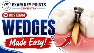 Wedges in Conservative Dentistry|BDS Exam|Easy Explanation for BDS students 