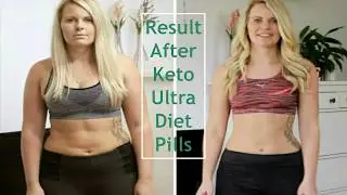 Keto Ultra Diet Pills: Shark Tank Keto Diet Pills for Weight Loss