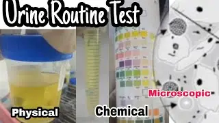 Urine  Routine Test | Urine Analysis |  Chemical Physical and Microscopic Exmination | MLT