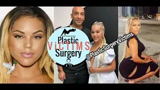 Ms Jacky Oh Dies after getting Mommy Makeover with Surgeon who was NOT Board Certified, She REGRETS