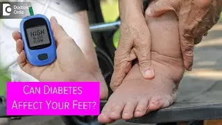 DIABETES AFFECTING FEET | High blood sugars & effect on Feet - Dr.Leela Mohan P V R |Doctors' Circle