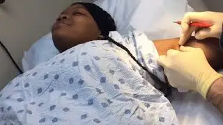 Getting my birth control taken out (NEXPLANON) RECOMMENDED ‼️‼️