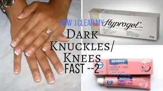 Which Works better?  Hyprogel Or Fashion Fair Cream