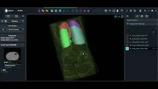 🫁 AI-Based Lung Segmentation on Chest CT | DCMCloud Web Viewer Demo