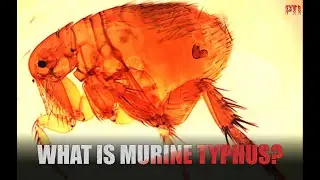 Kerala man infected with rare bacterial disease: What is Murine Typhus