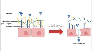 Pathogenesis of Vascular Leakage / Various ways in which Blood vessels Can leak