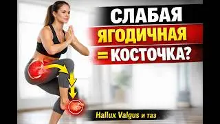 Если слабая СРЕДНЯЯ ЯГОДИЧНАЯ мышца, то жди Hallux Valgus