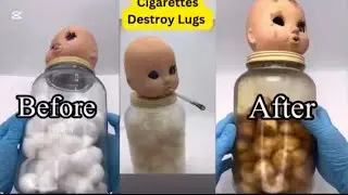 Before and After: The Shocking Effects of Smoking Cigarettes 😳😳😱😱