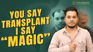 Baldness Gone, Hair On 😎 | Best Hair Transplant Clinic in Nagpur | New Roots