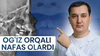 Bu muammoni qanday hal qildim? | O'zbek Ortodontlar klubi
