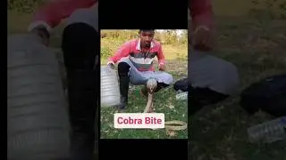 Cobra Bite Kar Deta🐍। #shorts। #youtubeshorts।#snakefacts। #viralshorts।