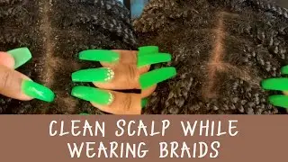 Cleaning my scalp while wearing braids