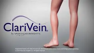ClariVein Animation Sequence