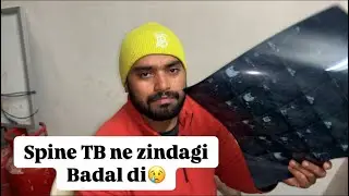 Mujhe Spine TB Ho Gayi 😔 | Injury, Dard aur Recovery Ki Poori Kahani&rdquo;