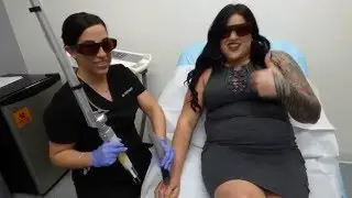 Knuckle Tattoo Removal Second Treatment