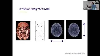 KCNI Invited Speaker Dr  Ariel Rokem   Neuroimaging data analysis in the age of AI 20250618 1501 1