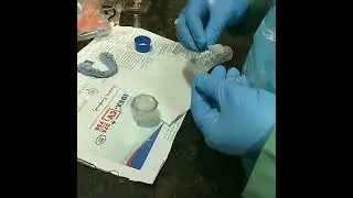 The Making Of A TMJ Splint.