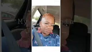 My hair fell out 🤷🏽&zwj;♀️ SO CUT IT all OFF‼️ Alopecia Journey #alopeciahairloss #alopecia #hairloss