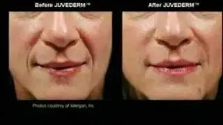 Online Makeover
