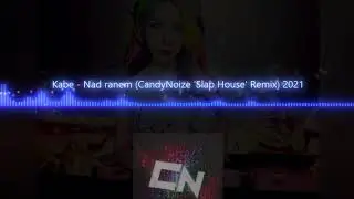 Kabe - Nad ranem (CandyNoize 'Slap House' Remix) 2021