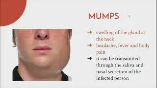 Common Childhood Diseases