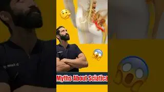 Sciatica Vs Piriformis Syndrome - The Top Causes of Sciatica and How to Tell if Which You Have