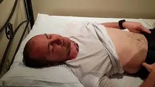 PARA603 OSCE - Abdominal assessment