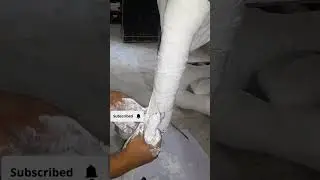 How to casting patella tendon bearing cast | PTB Cast Technique | Weight Bearing After Tibial Injury